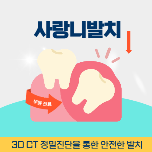 밀양치과 밀양시 치과 사랑니 발치