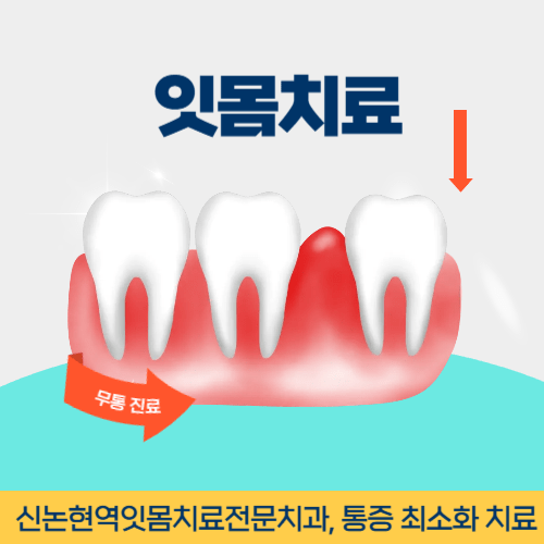 밀양치과 밀양시 치과 잇몸치료